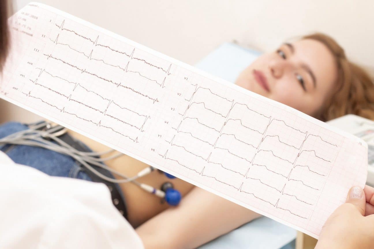 electrocardiograma-ce-este-cum-functioneaza-si-ce-informatii-ofera