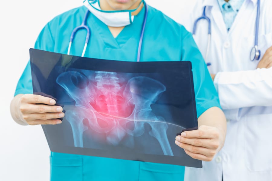 radiologie - Radiografie sacro-coccigiana