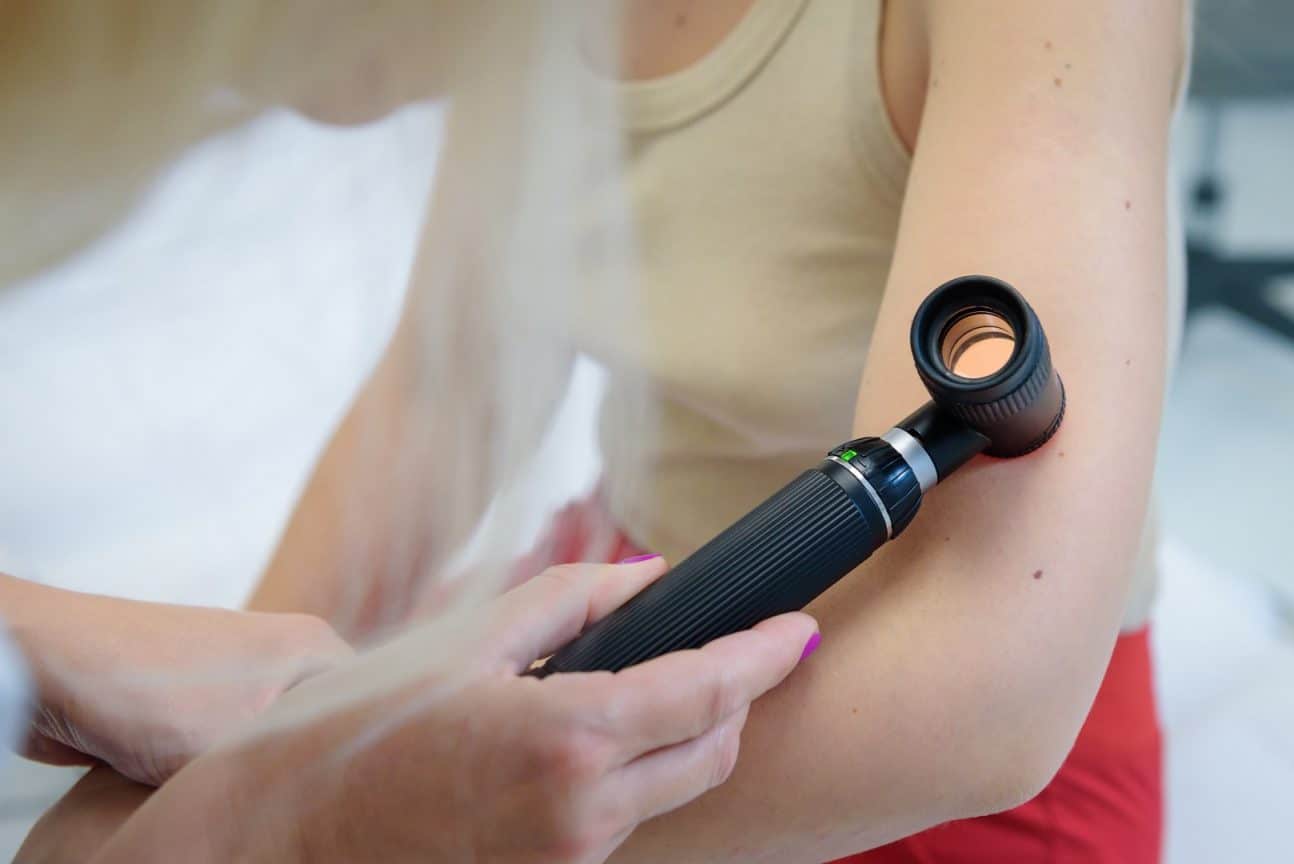 5 semnale ale pielii care cer analiza atentă a unui doctor dermatolog