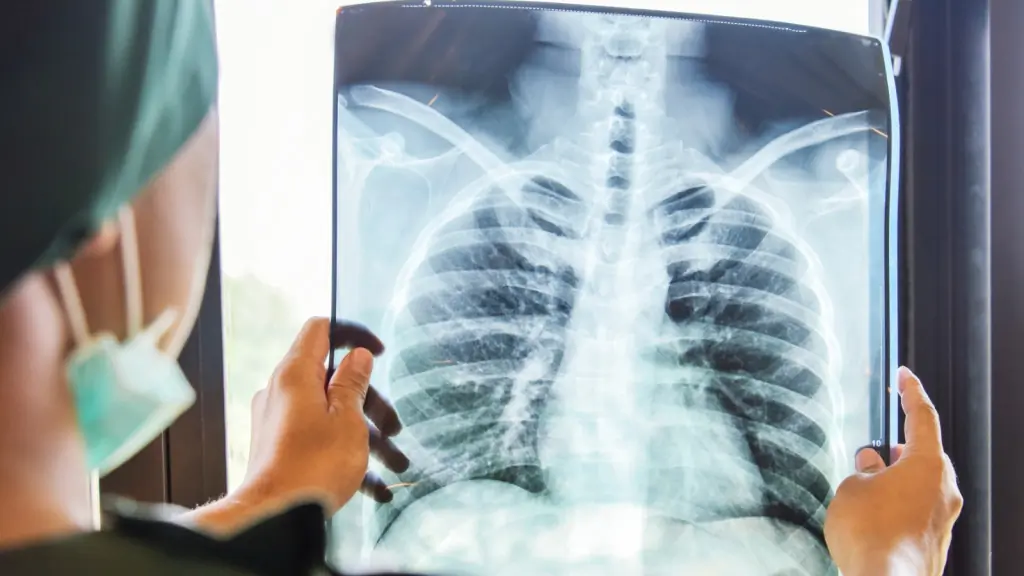 pneumologie-sector-3-bucuresti