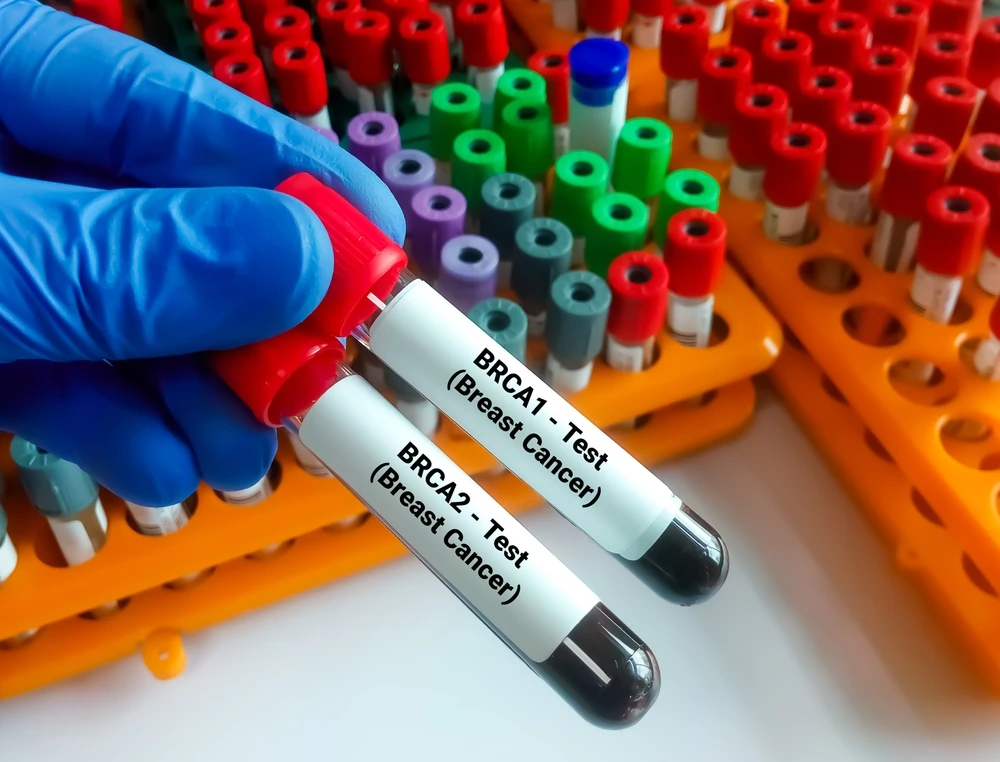 Eprubete cu sânge pentru testarea genelor BRCA1 și BRCA2