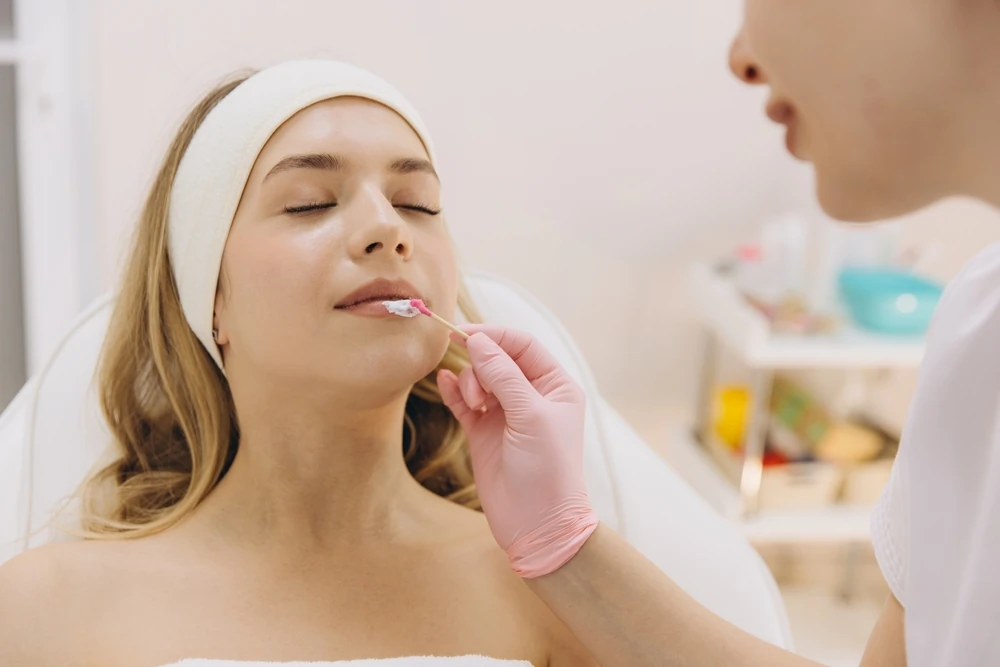 Aplicarea cremei anestezice pe buze înainte de injectarea cu acid hialuronic